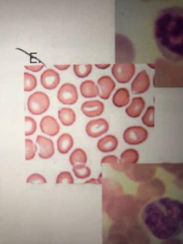 Blood lab flashcards