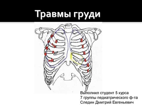 Травмы груди - презентация онлайн