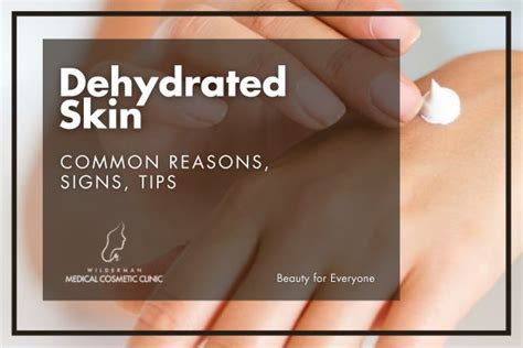 4 Signs Of Dehydration That Will Make You Drink More Water