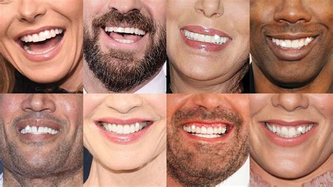 The High-Tech Hollywood Smile: How 3D Scanners And Artificial ...