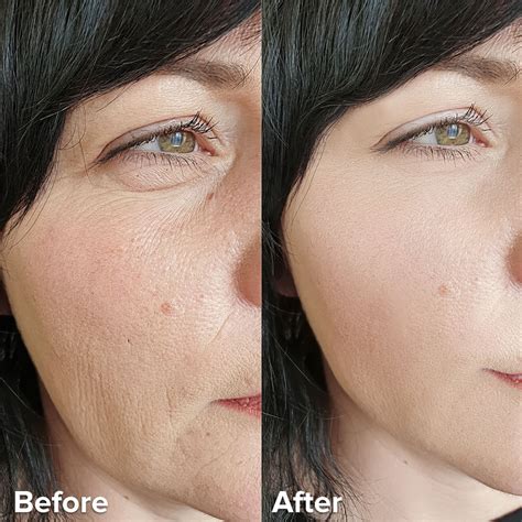 What Is Dmae For Skin? - GA Fashion