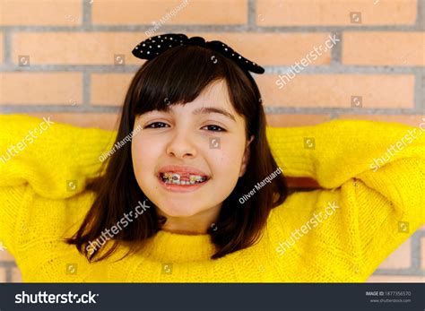 Portrait Girl Braces On Her Teeth Stock Photo 1877356570 | Shutterstock