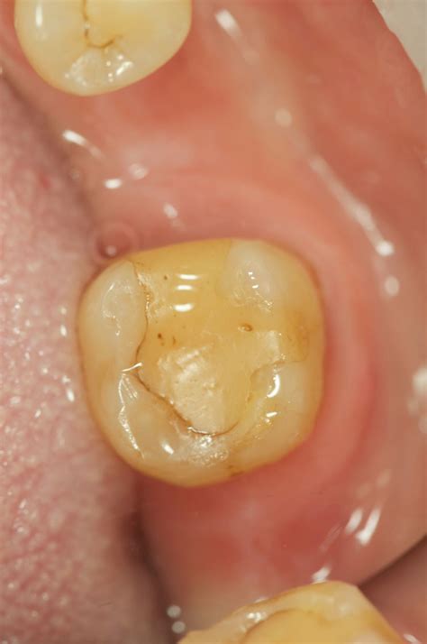 Стоматологическая клиника Dental-iq Невинномысск | Стоматология ...