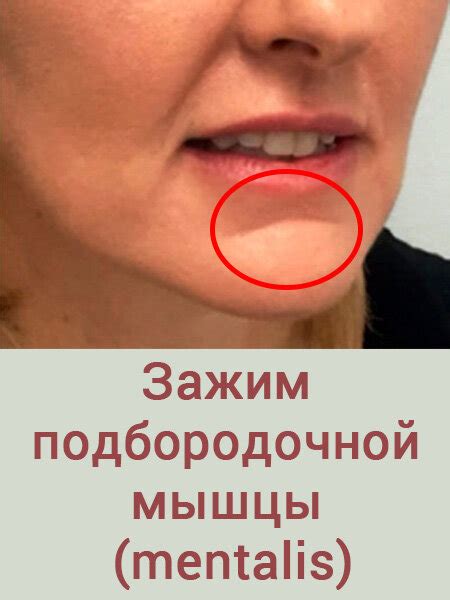 Почему образуется залом на подбородке. | Татьяна Новикова | Дзен