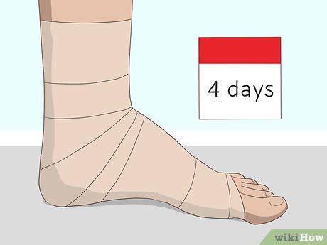3 Easy Ways to Wrap an Ankle with an ACE Bandage - wikiHow