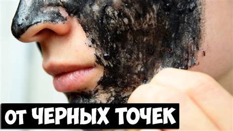 Черная маска от Черных точек своими руками. Быстро и Эффективно - YouTube