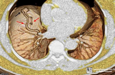 LearningRadiology