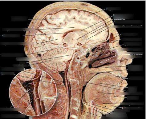 cadaver  diagram quizlet