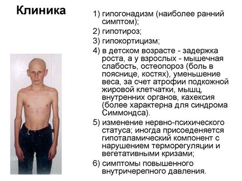 Заболевание гипоталамо-гипофизарной системы. Ее участие в корегировании ...