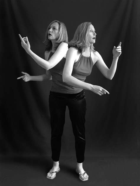 Wil Roberts 'Siamese Twins' | Conjoined twins, Twins, Siamese