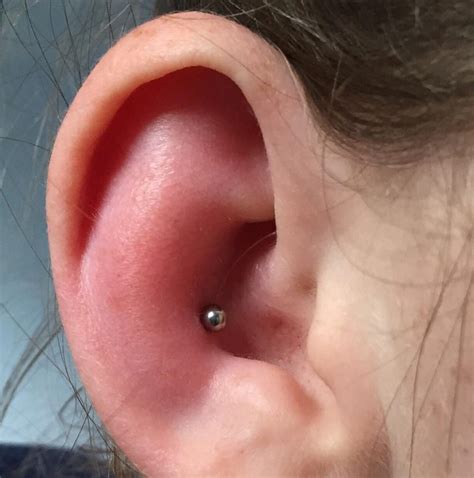 swollen cartilage piercing