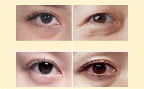 jellyprim vitamin  brightening eye cream private label skincare