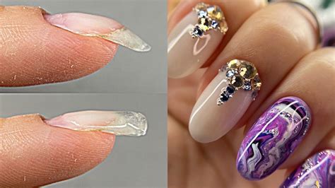 Как поднять клюющий ноготь пошагово💅 Мой самый лучший дизайн ногтей в ...