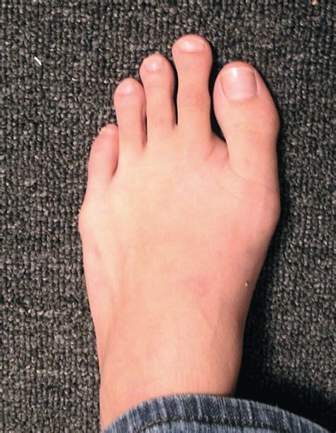 spiritual meaning    toe longer   big toe