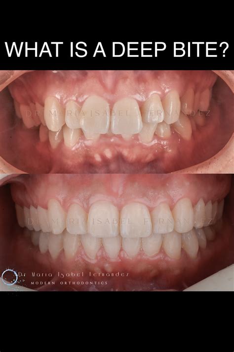 deep bite smile studios  medical center  bahrain gcc