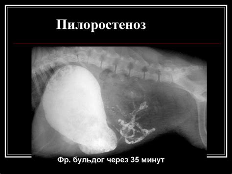 Контрастная рентгенография - online presentation