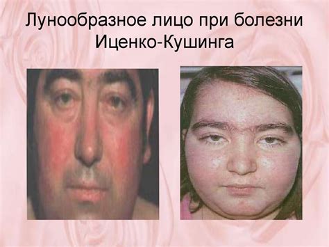 Лекция №2 Методы обследования пациента в сестринской практике ...