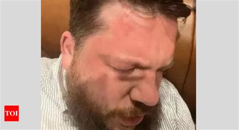 Navalny's aide Leonid Volkov returns home after attack, Lithuania ...