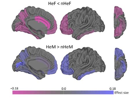 大规模研究观察到：同性恋者大脑与异性恋者存在差异|神经生物学|异性恋者|同性恋者|磁共振|性取向|基因|因素|遗传|-健康界