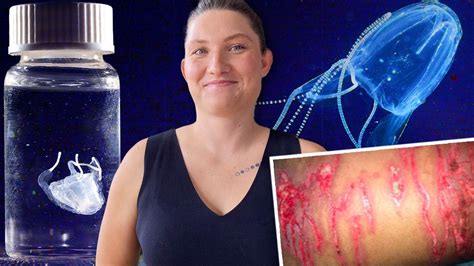 Irukandji jellyfish stings on rise prompt fears for southeast ...