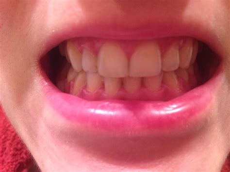 barbara une histoire de dents