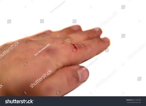 Male Hand Bleeding Index Finger Isolated Stock Photo (Edit Now) 591189182