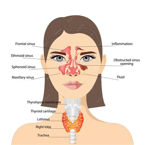 Throat Diagram With Glands