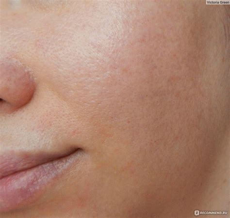 Пенка для умывания Icon Skin ''Ideal Balance'' с кислотами для ...
