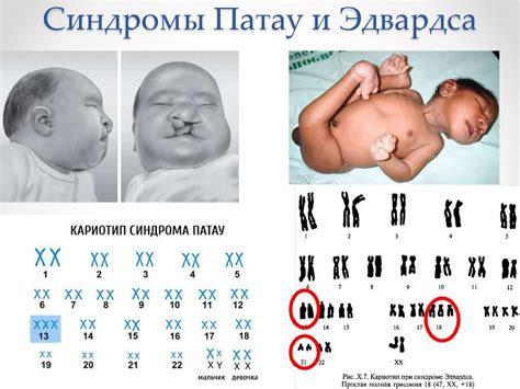 Наследственная и ненаследственная изменчивость - презентация онлайн