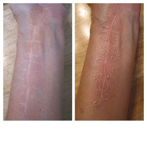 tattoo for cover scar 8
