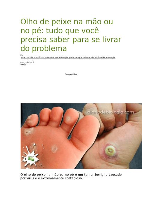 Olho De Peixe Na Mão No Começo - 5