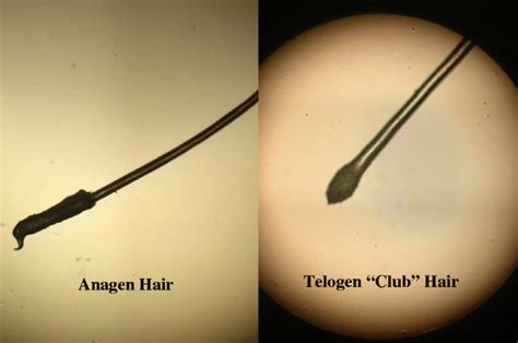 Healthy Hair Under Microscope