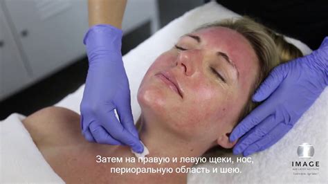 Бета пилинг - YouTube