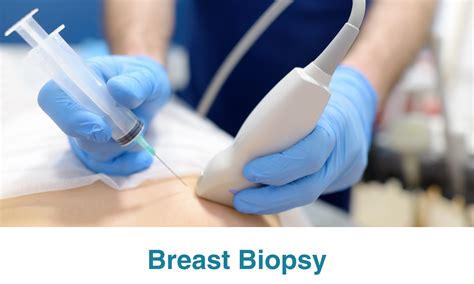 What is a Breast Biopsy? - Apollo Hospitals Blog