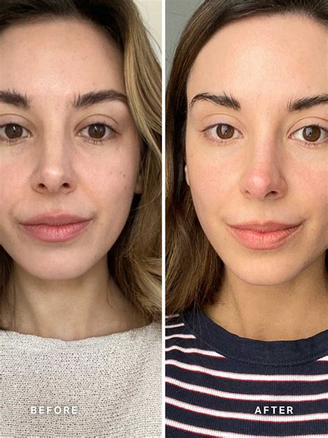 いろいろ vitamin c serum before and after photos 109717-Vitamin c serum ...