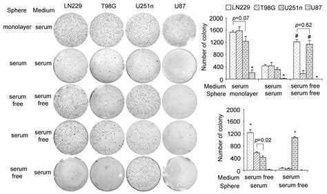 Glioblastoma cell line-derived spheres in serum‑containing medium ... 