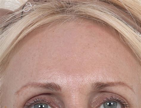Karisma Lebanon - Before & After
