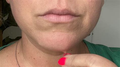 Can You Actually Prevent Chin Hairs?