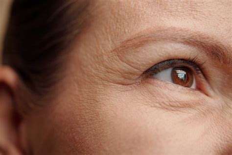 prevent soften  eye wrinkles  smart skincare