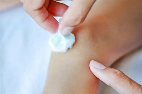 6 проверенных способов снять зуд от укусов насекомых / Малютка