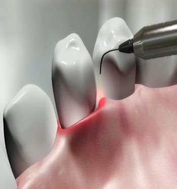 Most Trusted Dental Experts | Complete Dental Care under One Roof ...