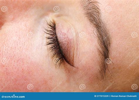 Closed Eyelid. Permanent Make-up of the Eyelids, Eyelash Tattooing ...