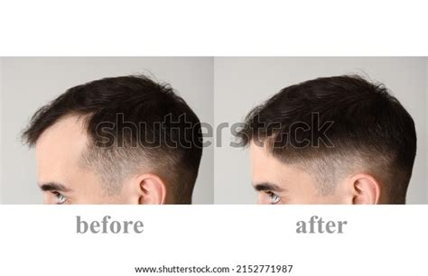 hair growth black royalty  images stock