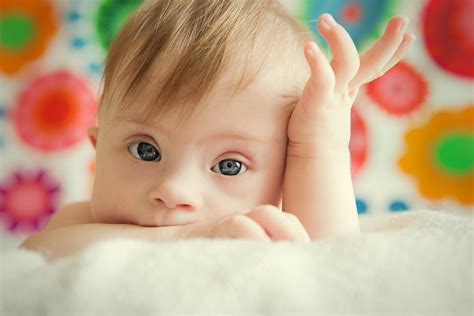 symptoms   syndrome facty health