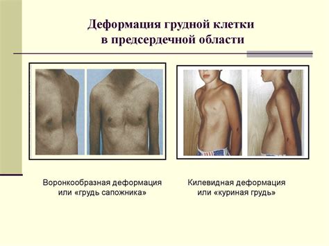 Семиотика заболеваний сердечно-сосудистой системы - презентация онлайн