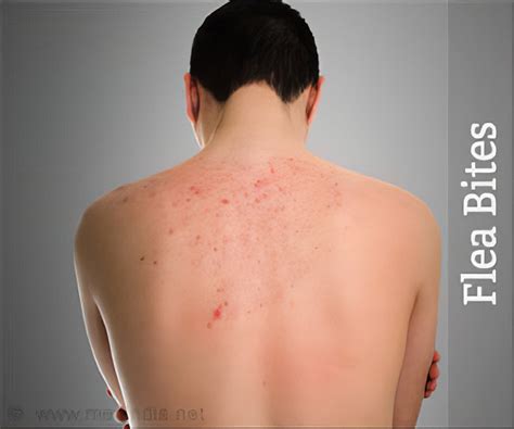 dog flea bites    gertrude howard blog