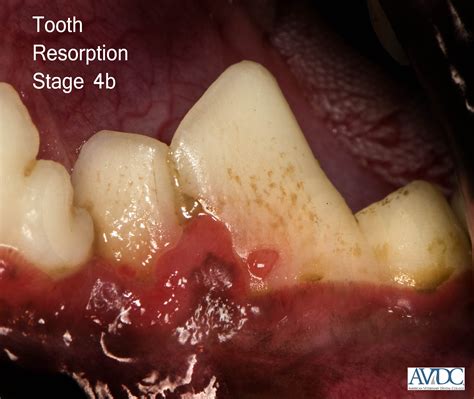 Tooth Resorption - Veterinary Online Courses