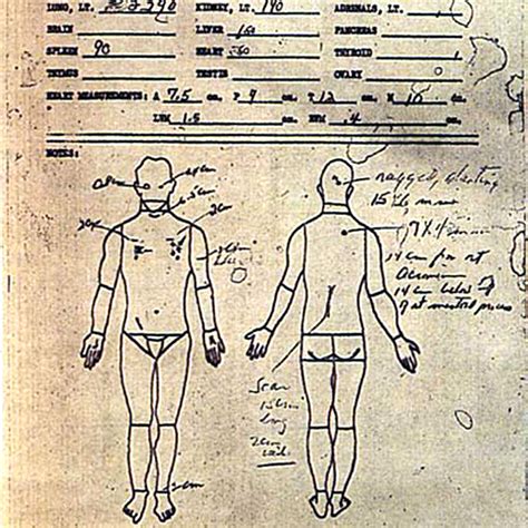 Laci Peterson Autopsy: The Pictures That Haunt Us Still Image 15