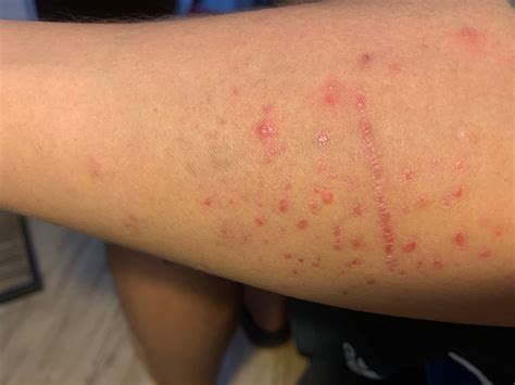 Mysterious Rash - Please help : r/medical