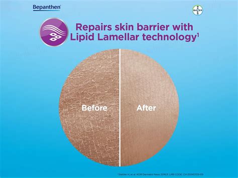 Buy Bepanthen SensiCalm Steroid-Free Itch Relief Cream For Eczema-Prone